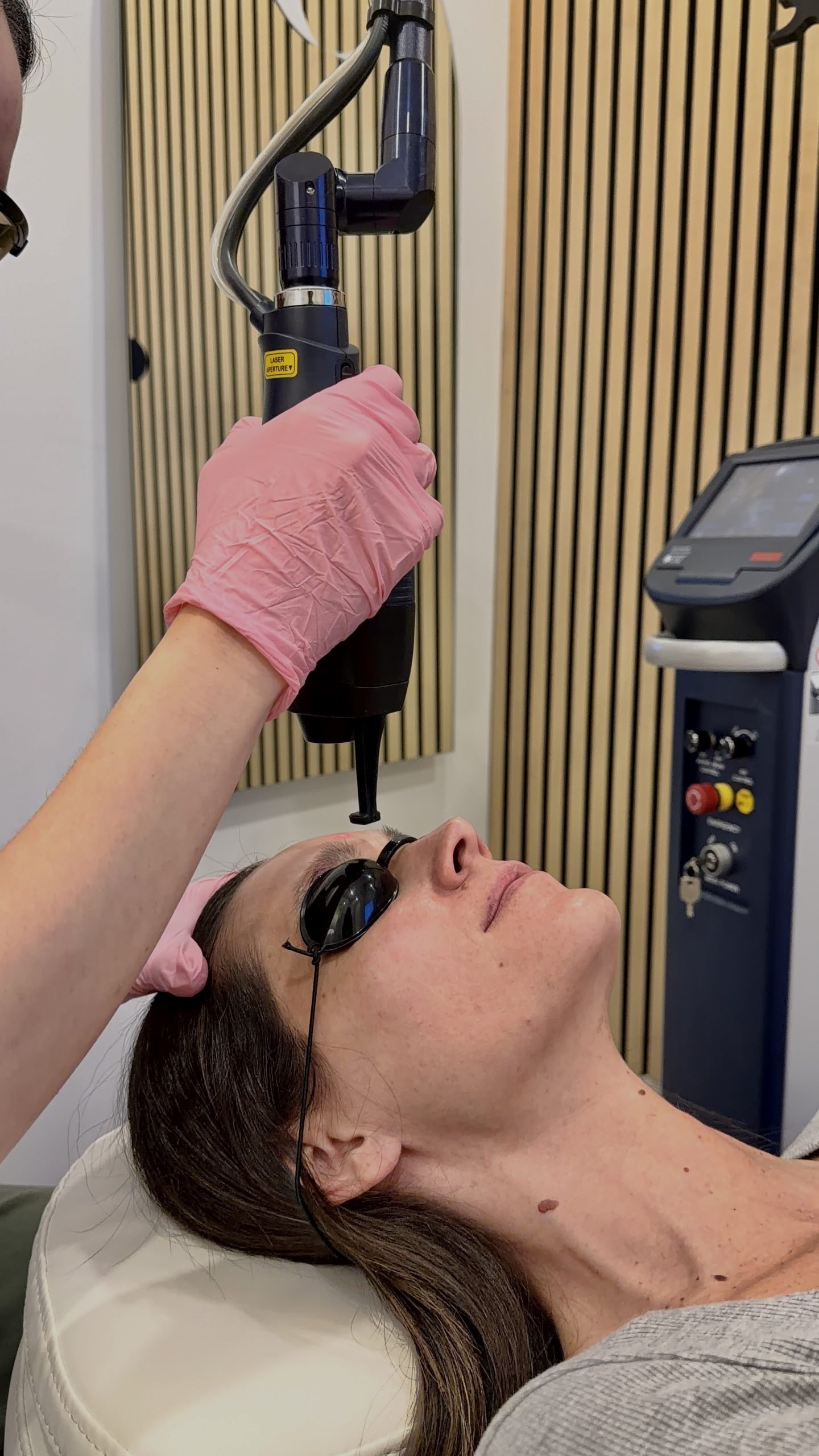 Ablative CO2 Laser