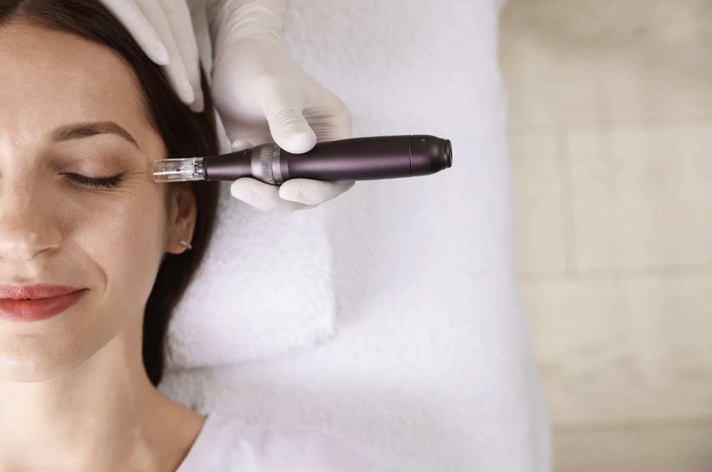 Microneedling