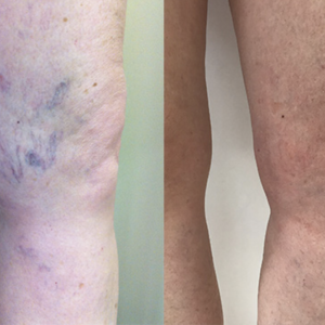 Screenshot 2026-03-13 at 11.45.44 AM