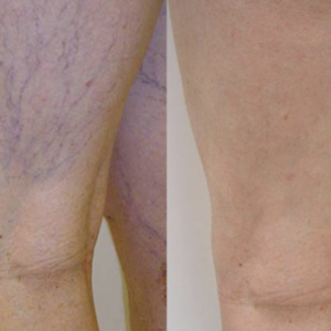 Screenshot 2026-03-13 at 11.46.26 AM